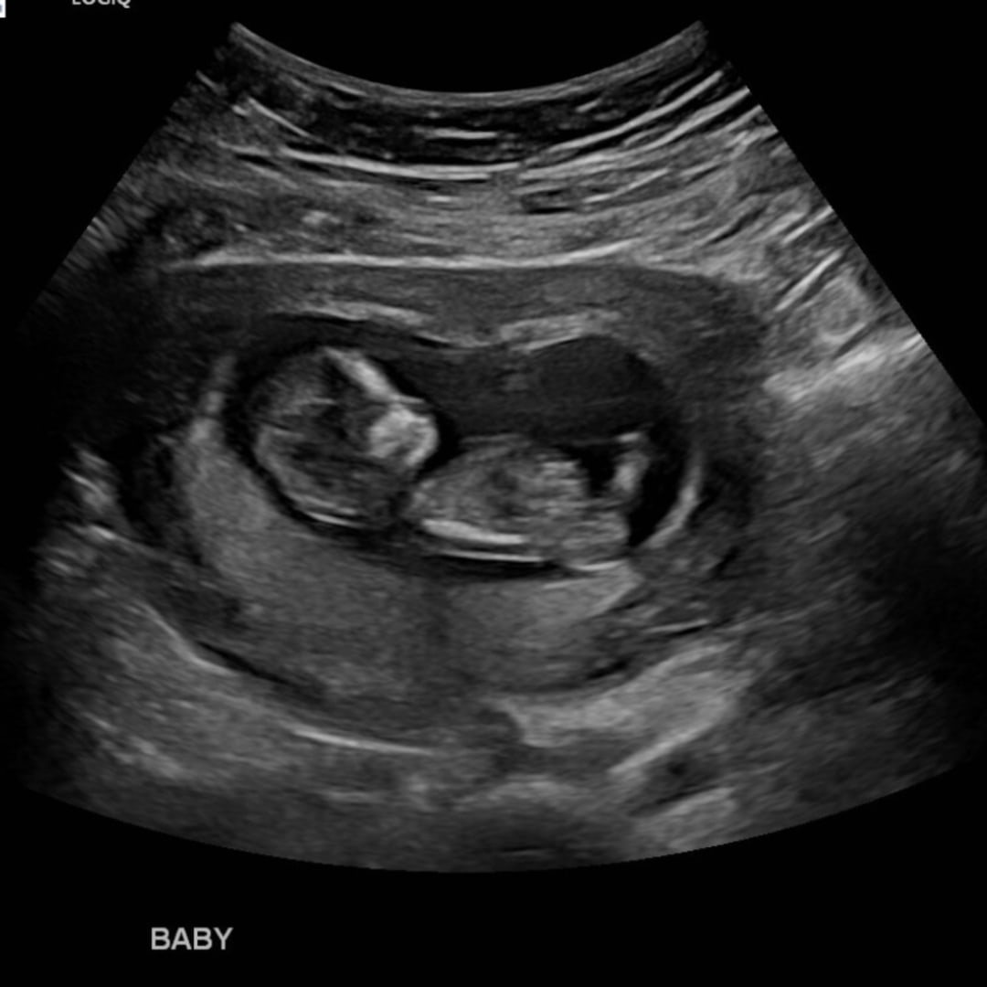 Photo shared by Johannah for their Babylist baby registry.