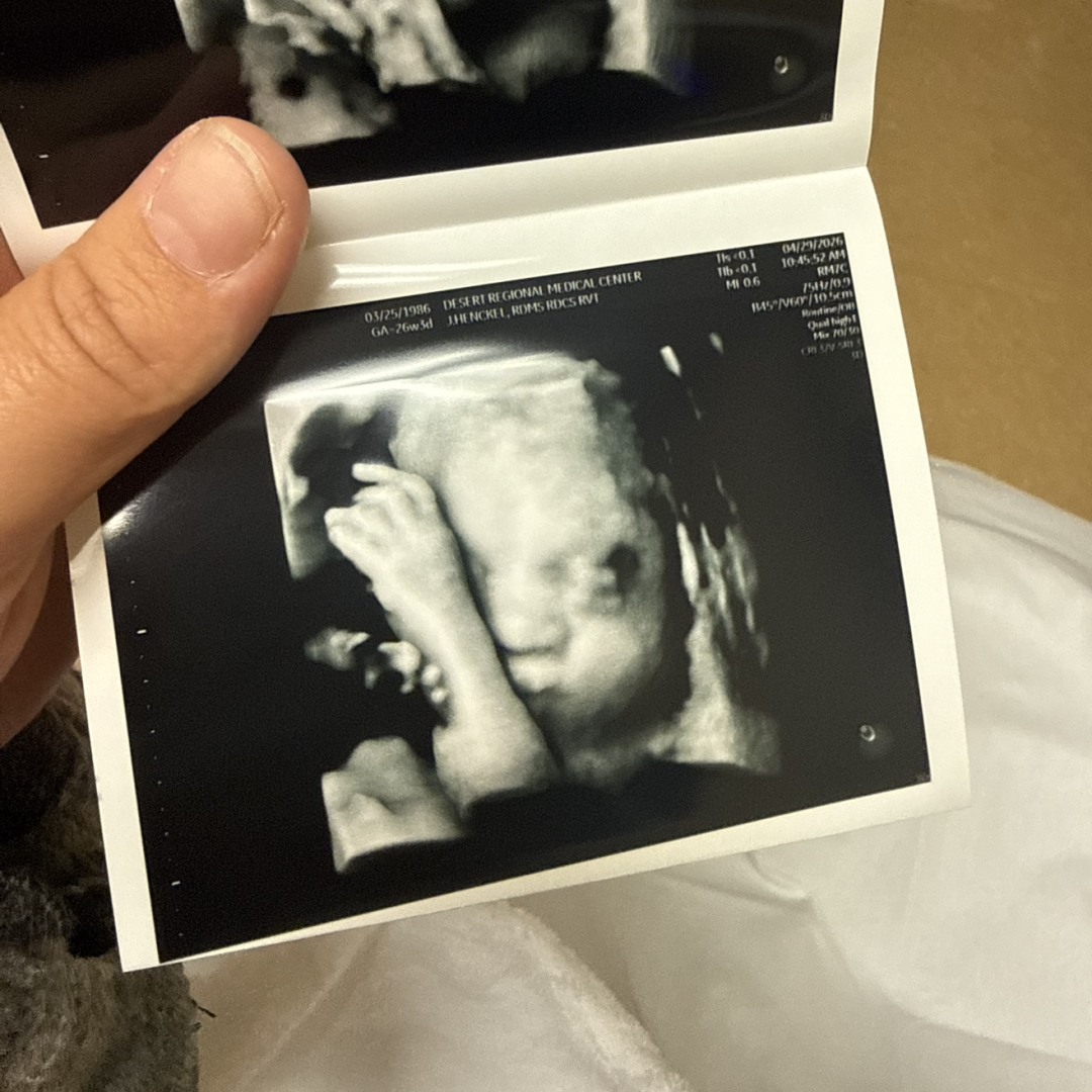 Photo shared by Athena for their Babylist baby registry.