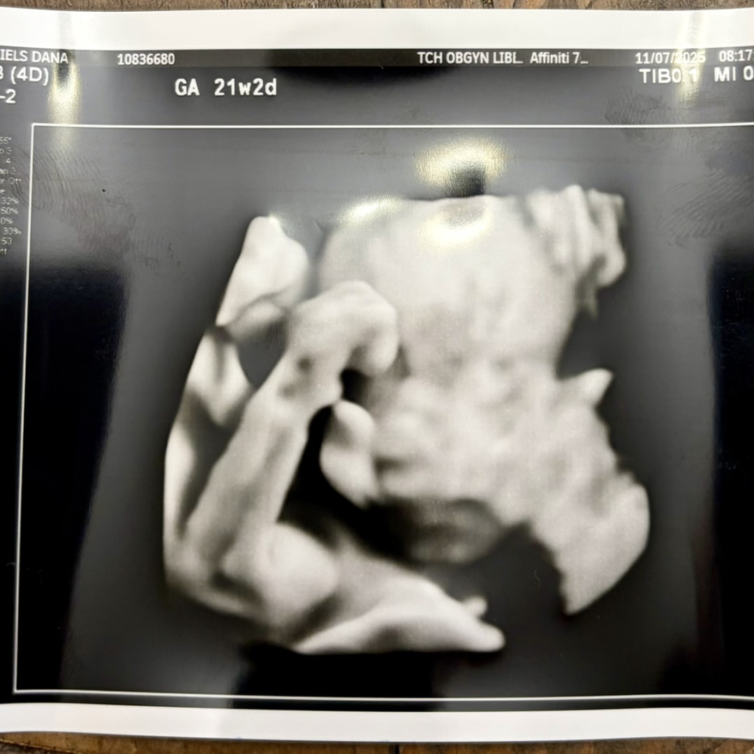 Photo shared by Dana for their Babylist baby registry.