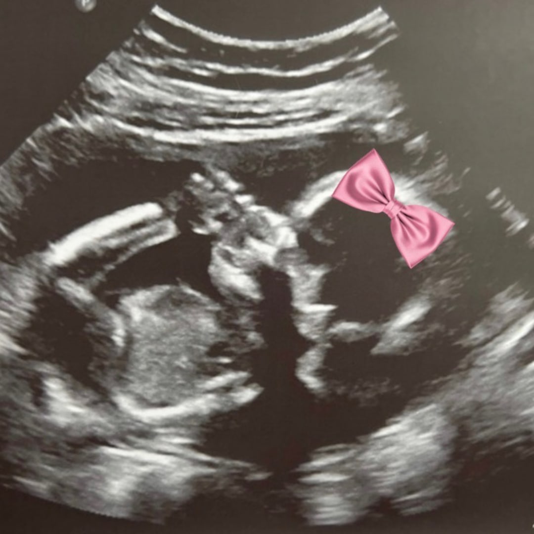 Photo shared by Julia for their Babylist baby registry.