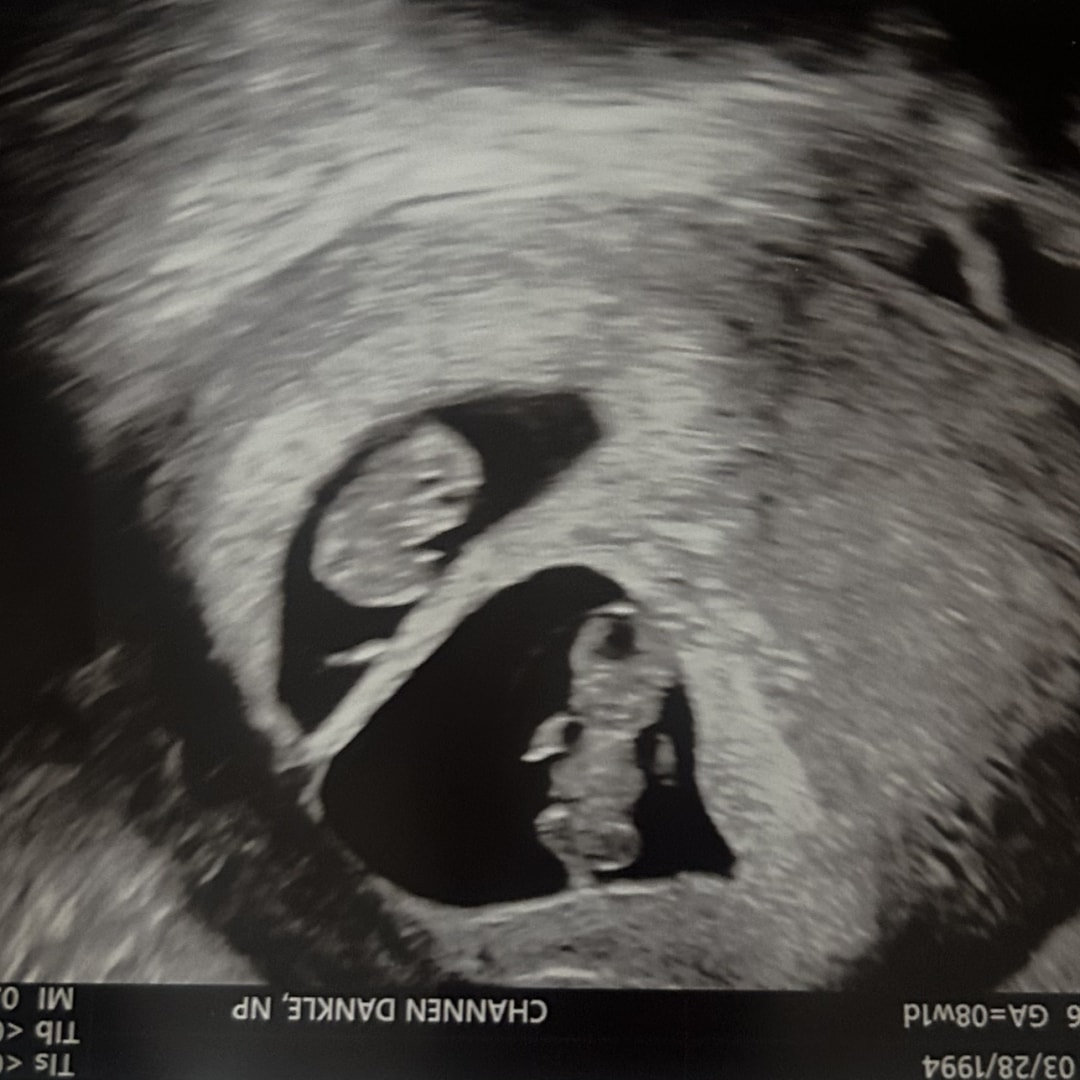 Photo shared by Madison for their Babylist baby registry.