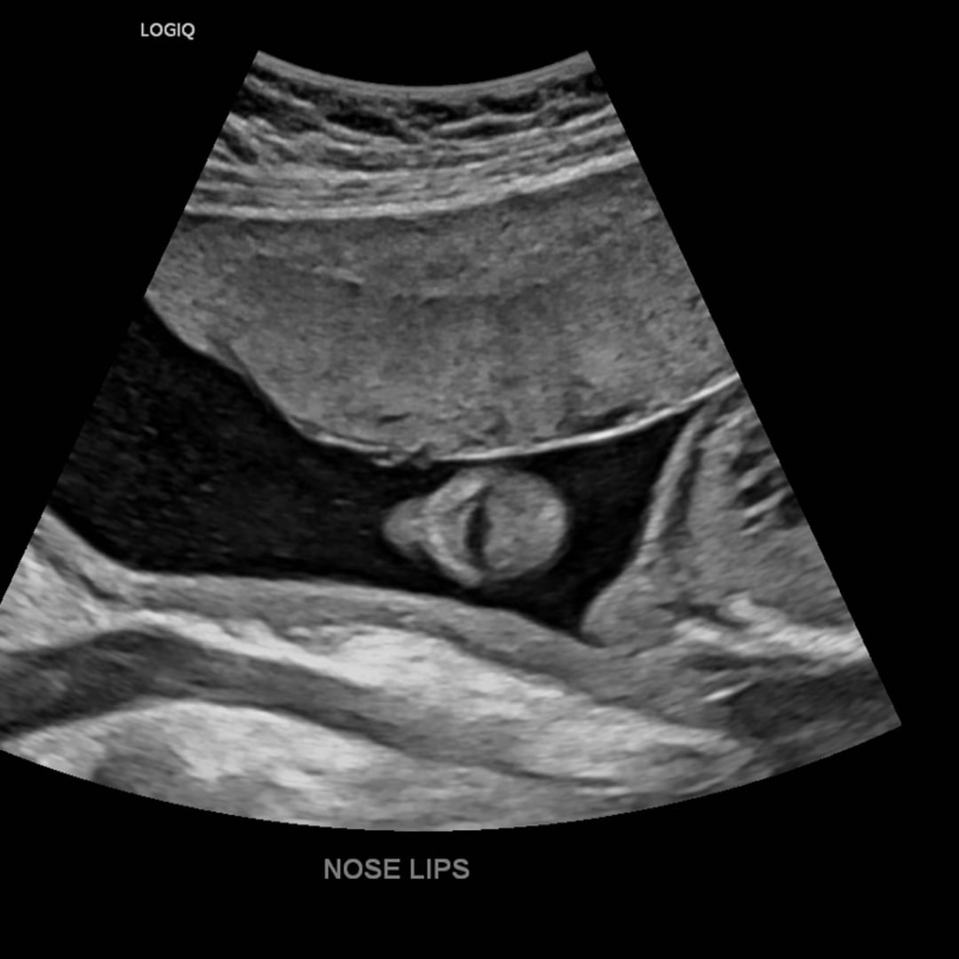 Photo shared by Blaize for their Babylist baby registry.