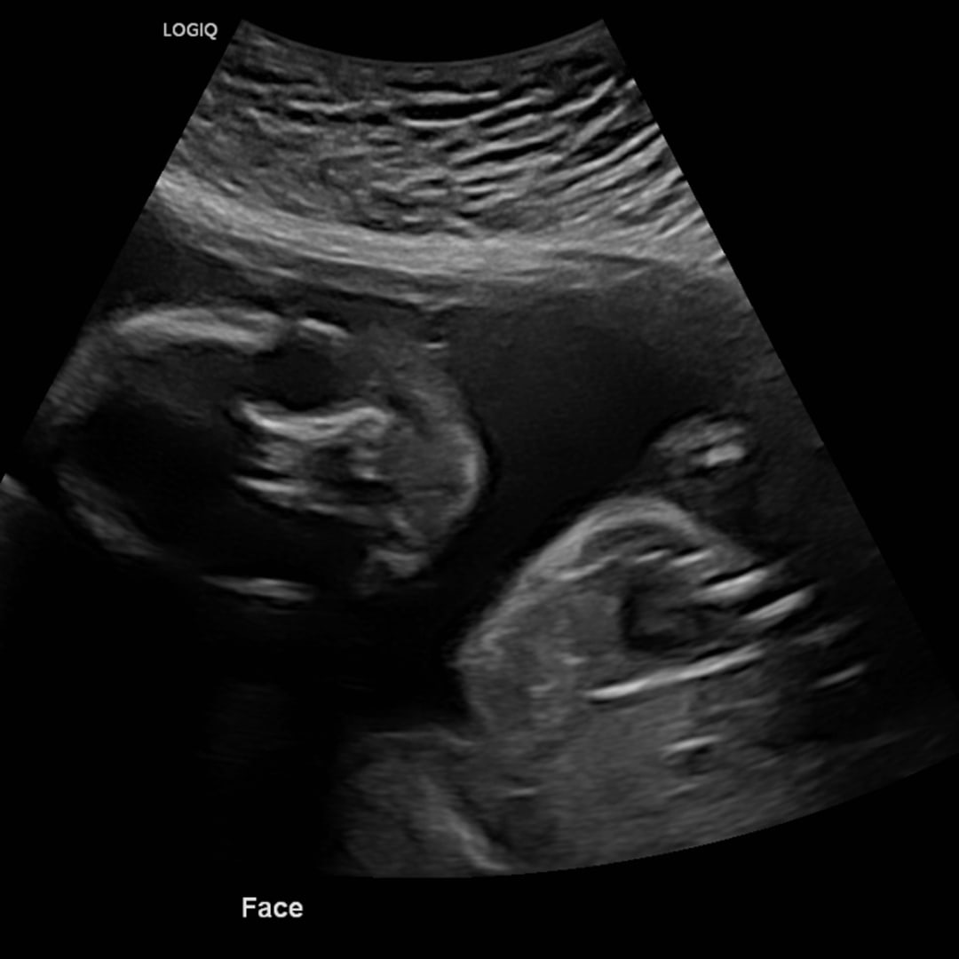 Photo shared by Abigail for their Babylist baby registry.