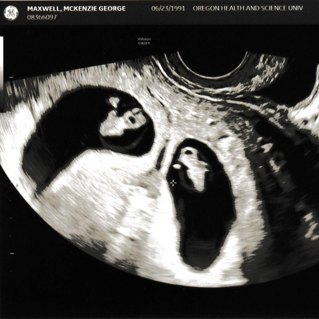 Photo shared by McKenzie for their Babylist baby registry.