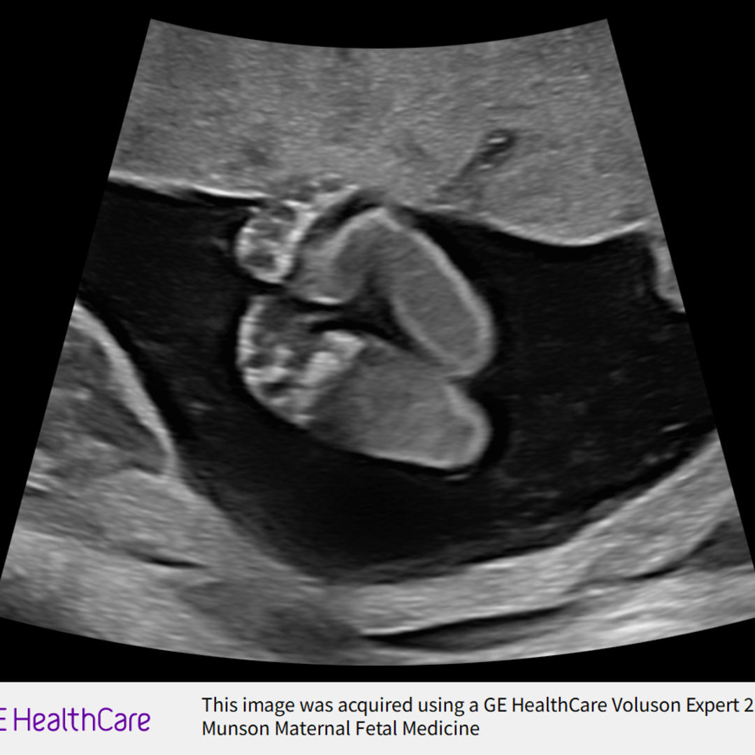 Photo shared by Shea for their Babylist baby registry.