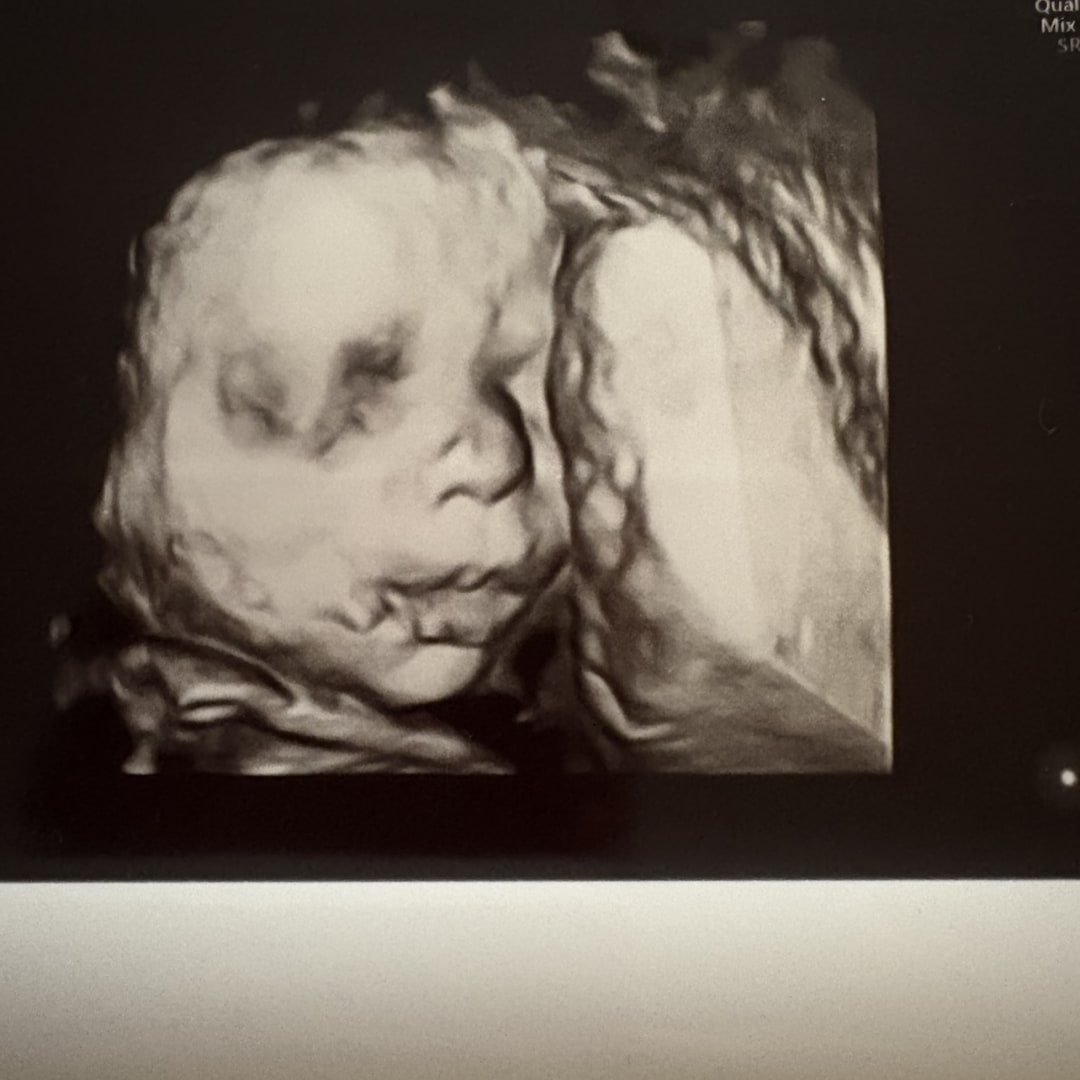 Photo shared by Celia for their Babylist baby registry.