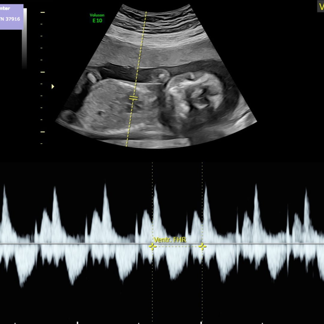 Photo shared by Liz for their Babylist baby registry.