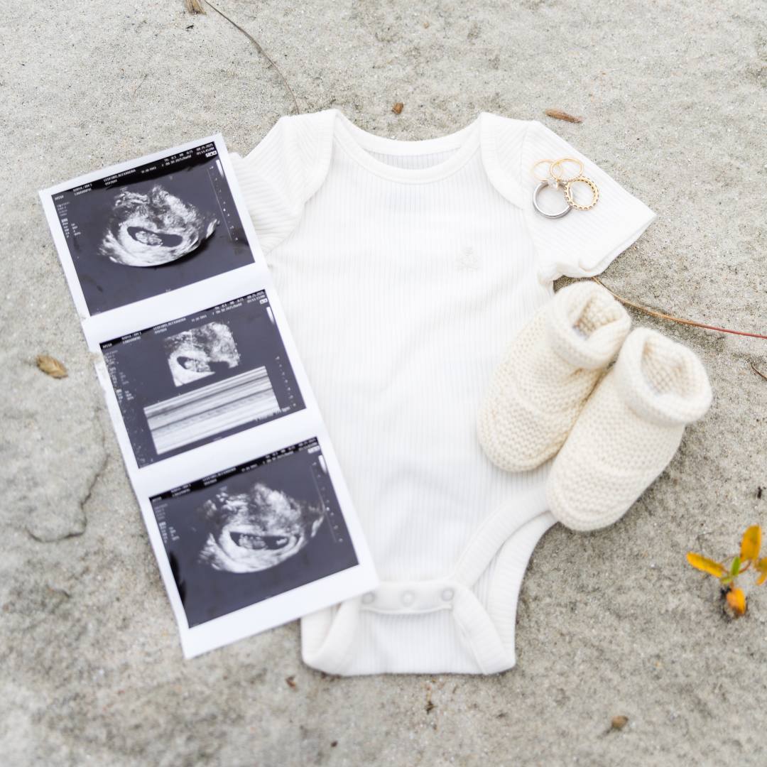 Photo shared by Allie for their Babylist baby registry.