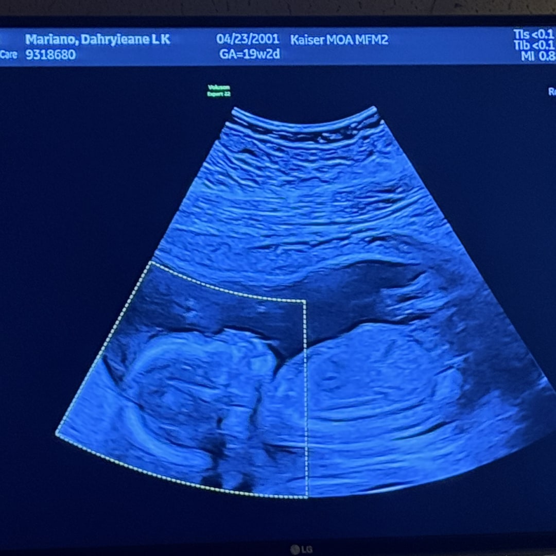 Photo shared by Dahryieane for their Babylist baby registry.