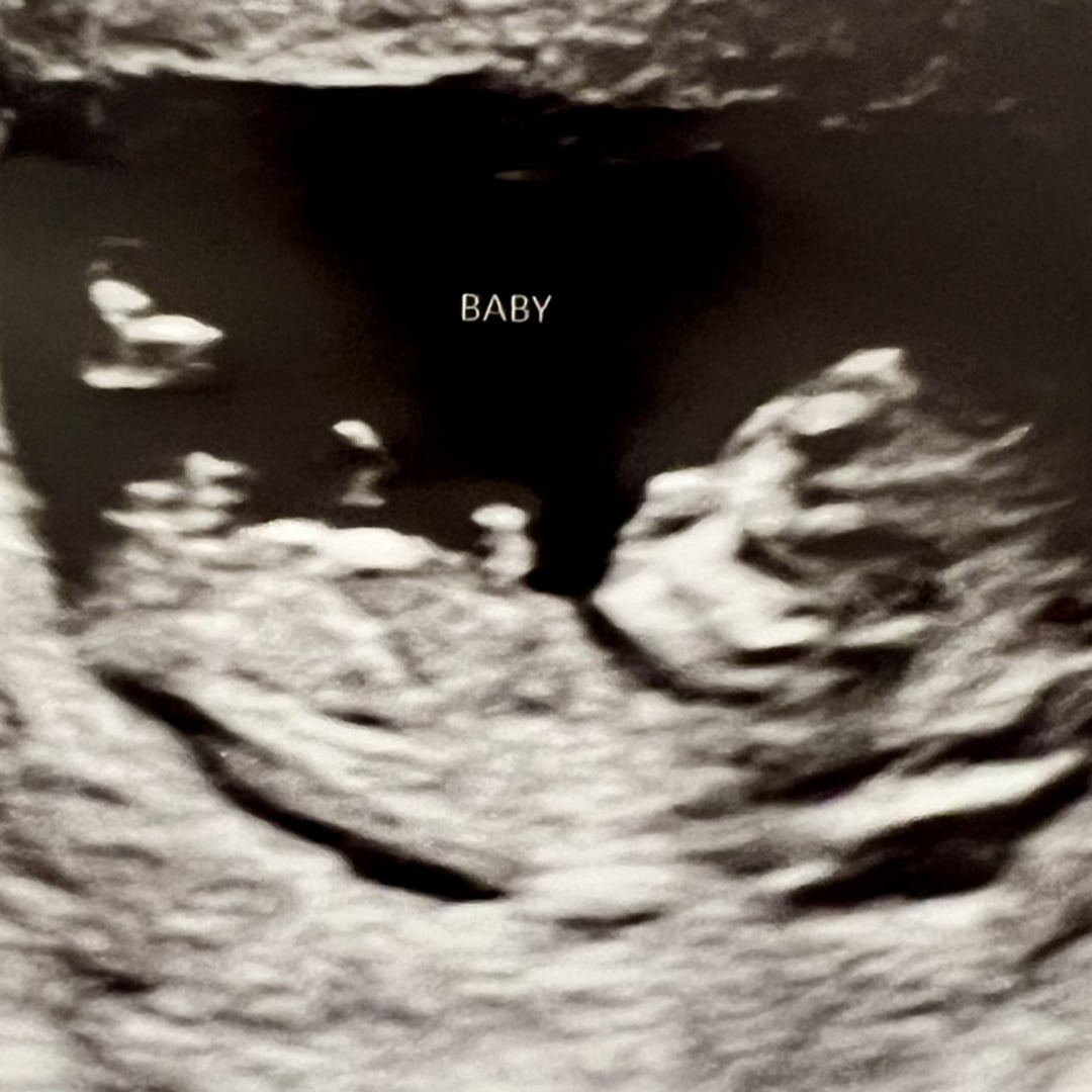 Photo shared by Vandi for their Babylist baby registry.