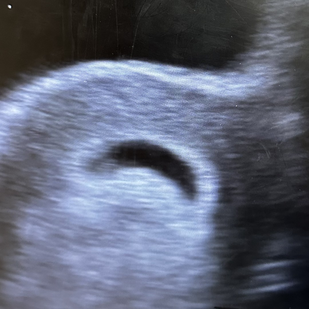 Photo shared by Caralynn for their Babylist baby registry.