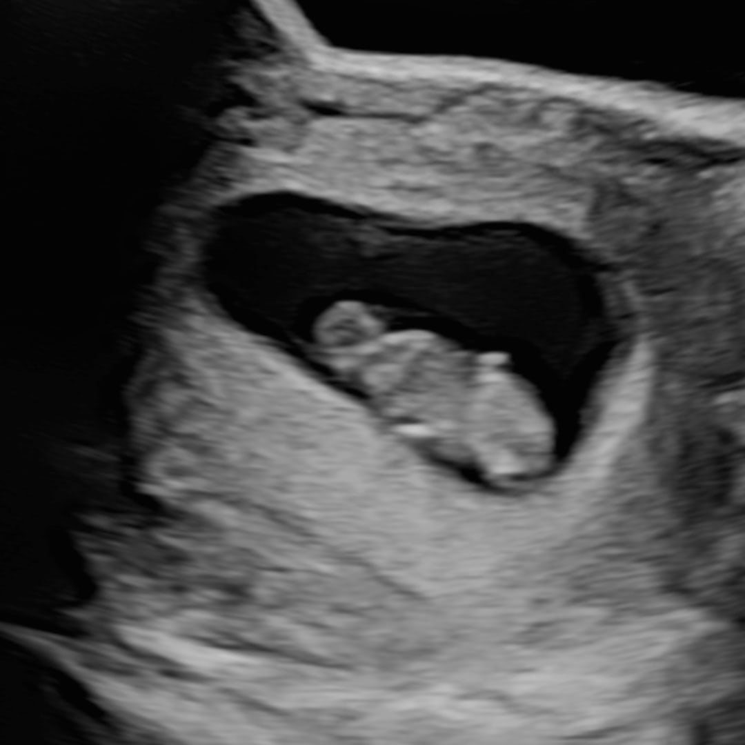 Photo shared by Carly for their Babylist baby registry.