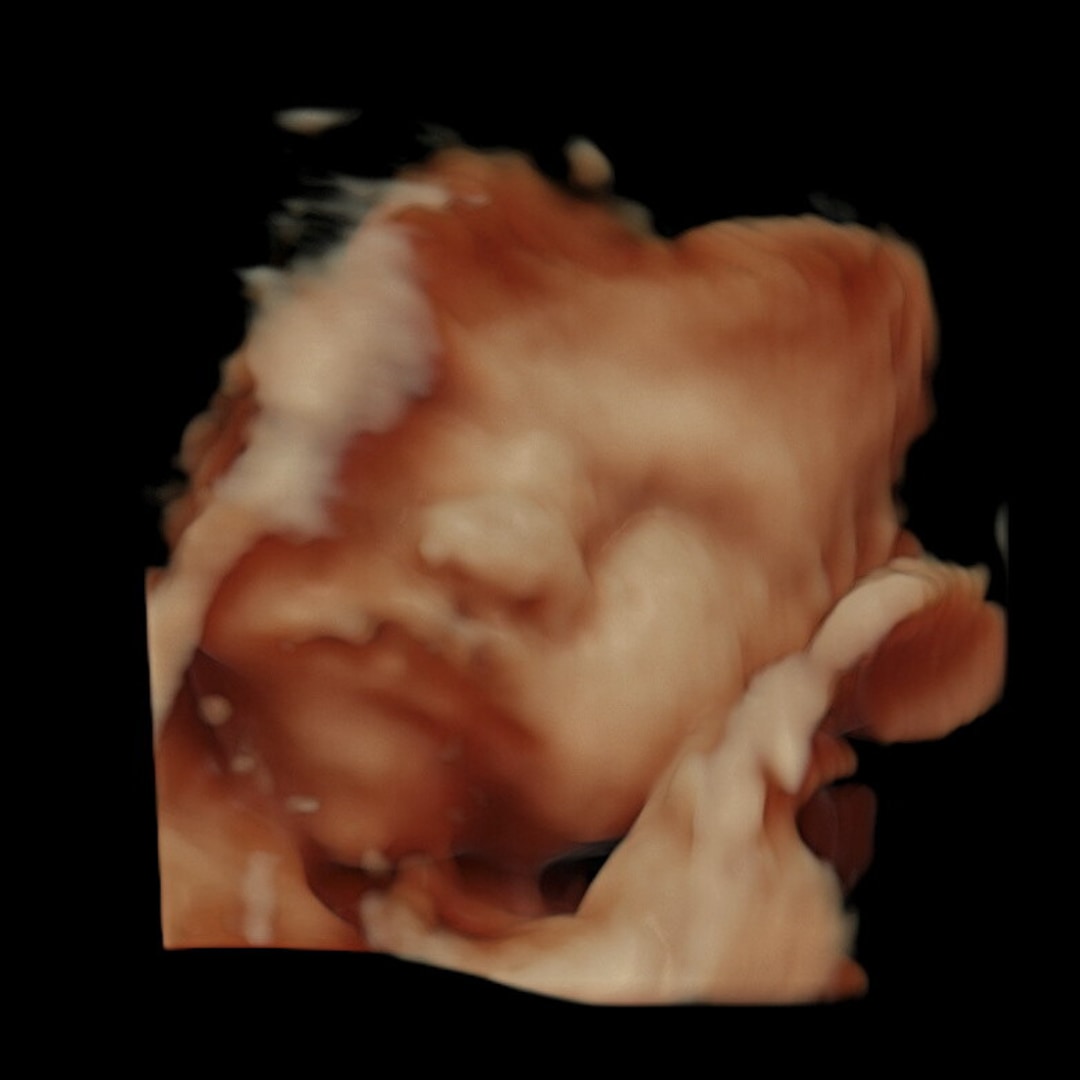 Photo shared by Harlie for their Babylist baby registry.