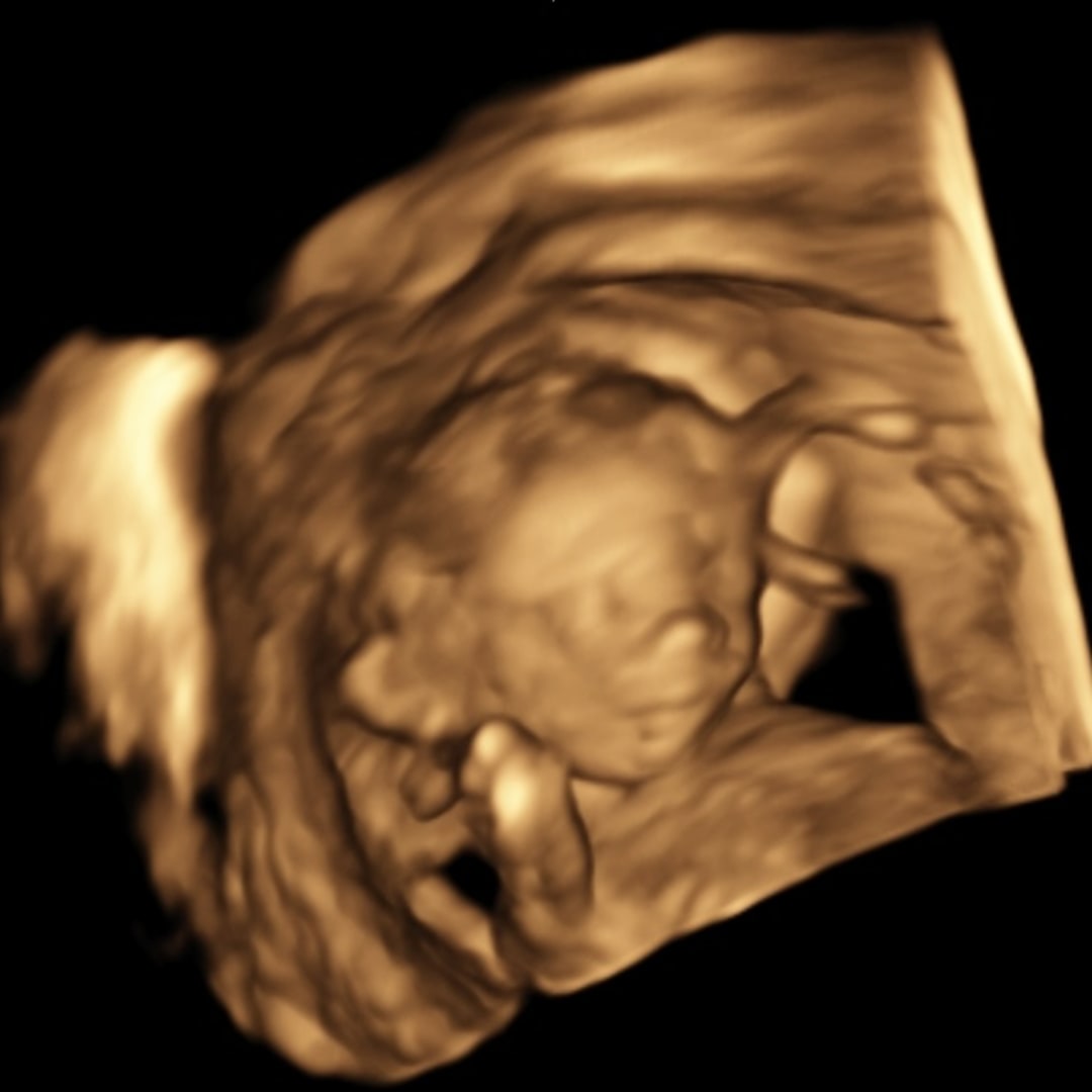 Photo shared by Camille for their Babylist baby registry.