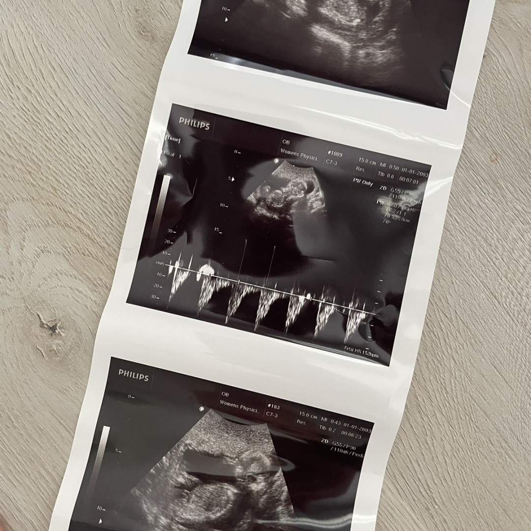 Photo shared by Amy for their Babylist baby registry.