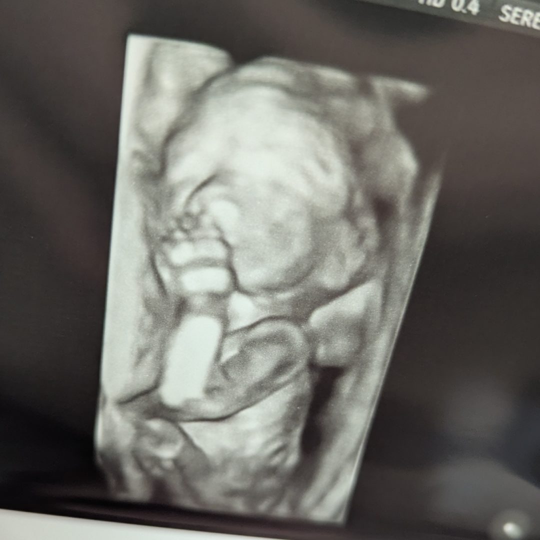 Photo shared by Brittany for their Babylist baby registry.