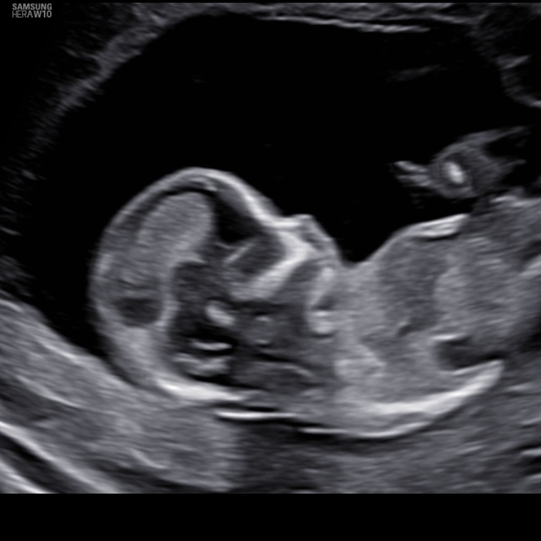 Photo shared by Savannah for their Babylist baby registry.