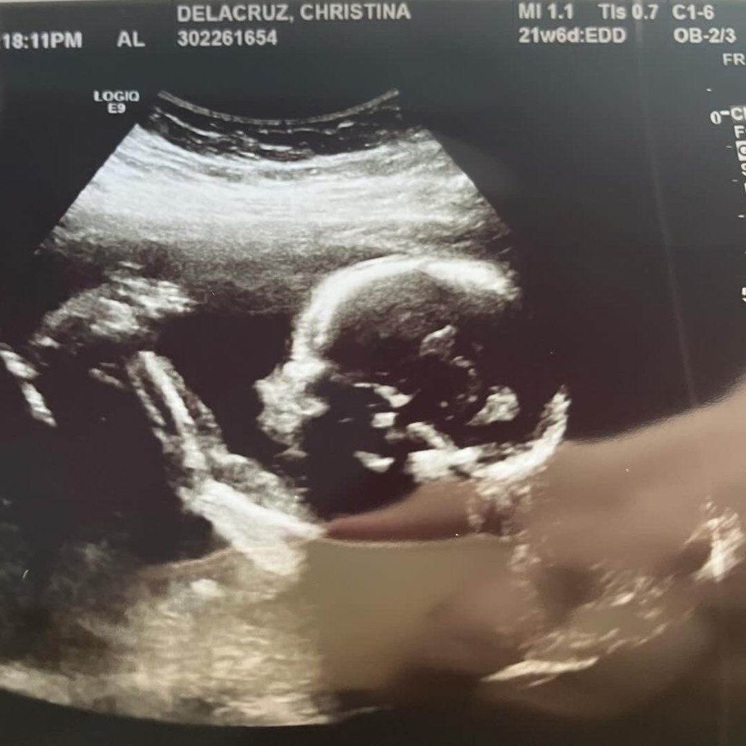 Photo shared by Christina for their Babylist baby registry.