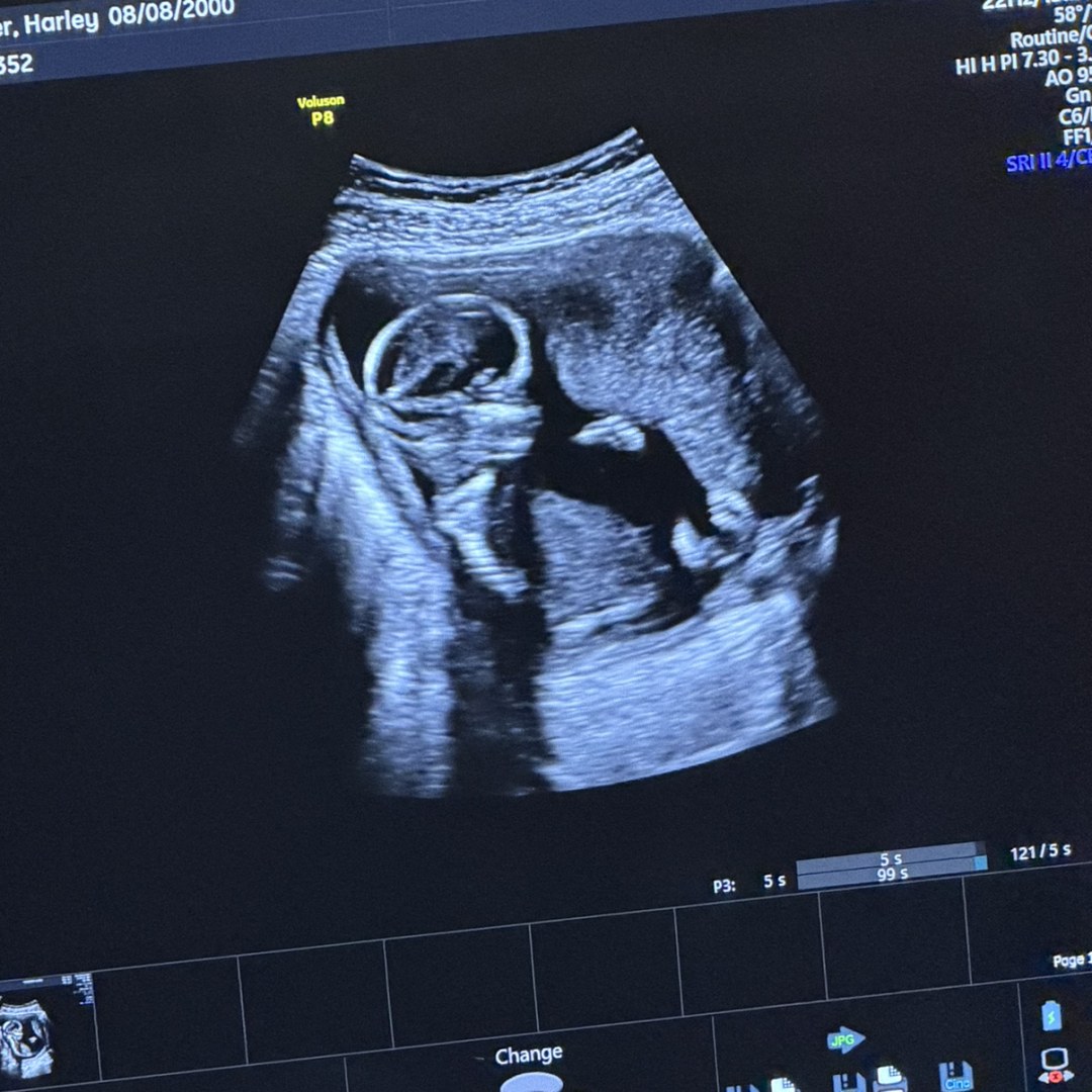 Photo shared by Harley for their Babylist baby registry.