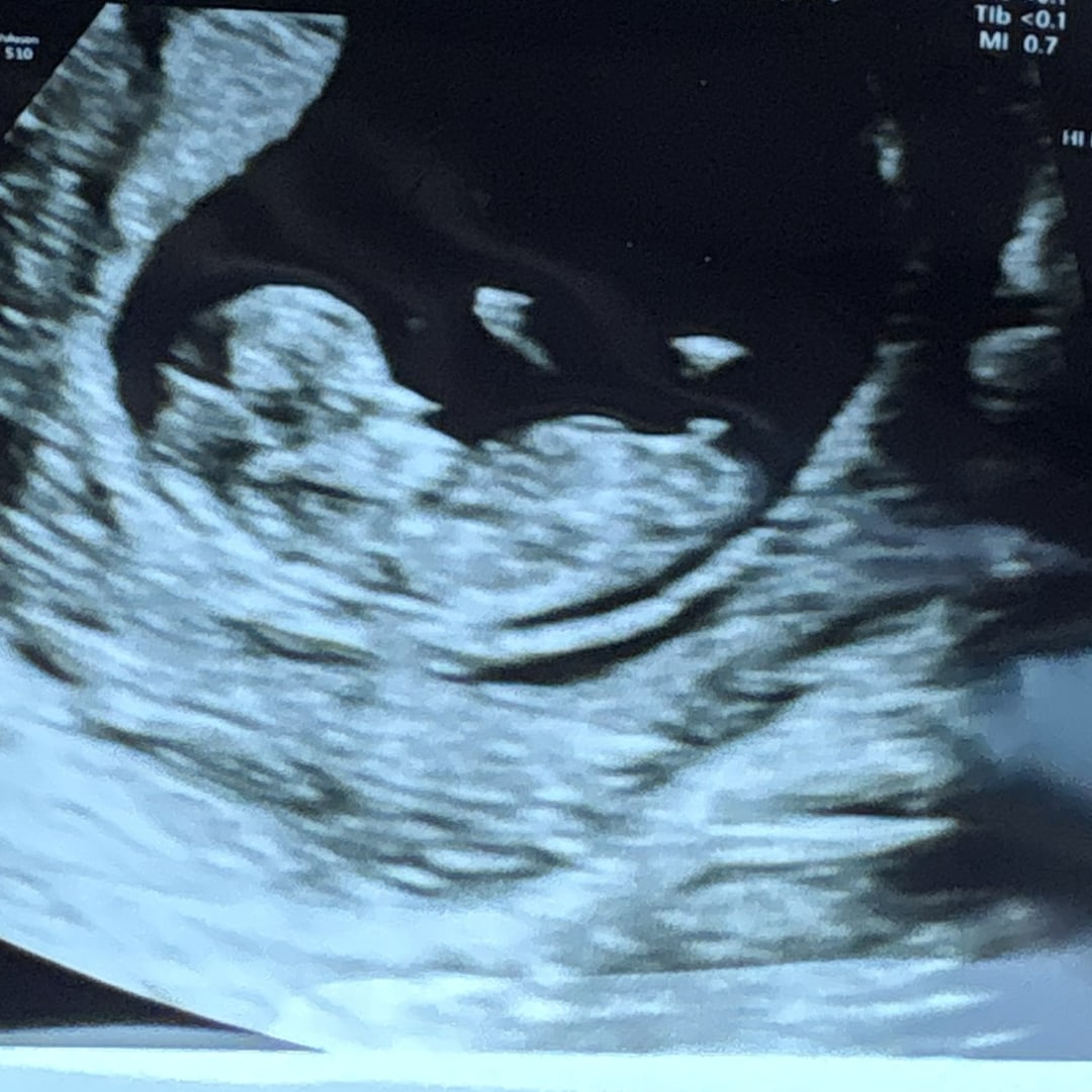 Photo shared by Gabby for their Babylist baby registry.
