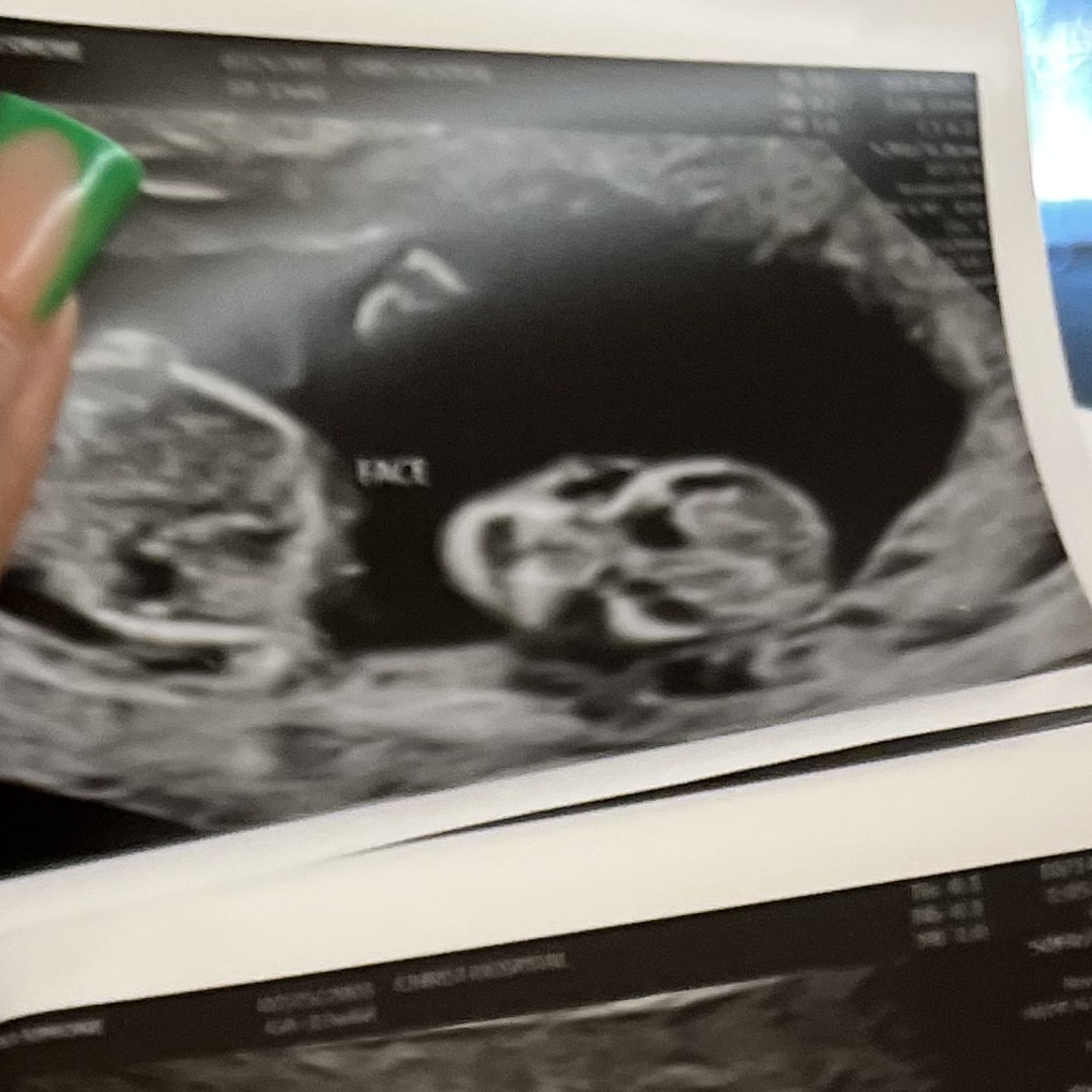 Photo shared by Naki for their Babylist baby registry.