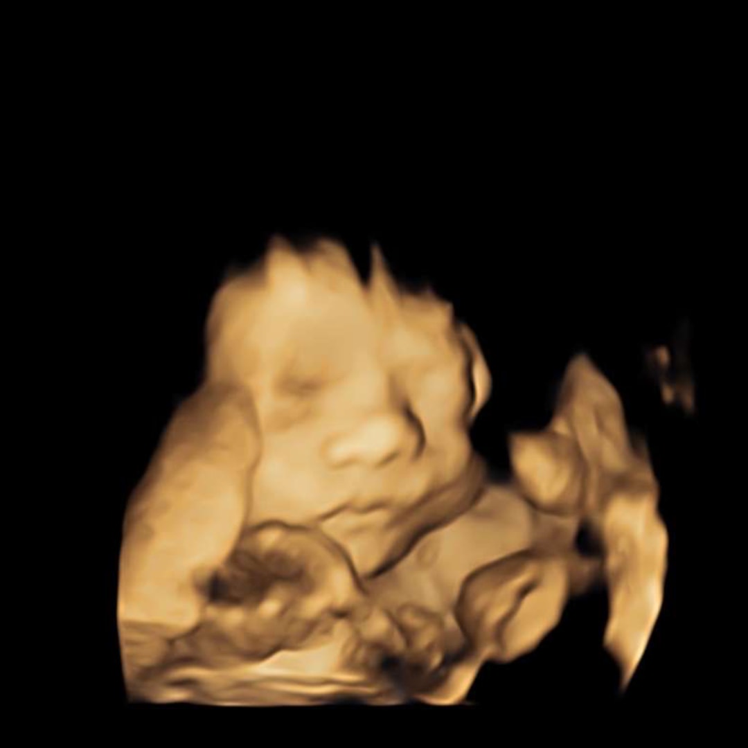 Photo shared by Ashleigh for their Babylist baby registry.