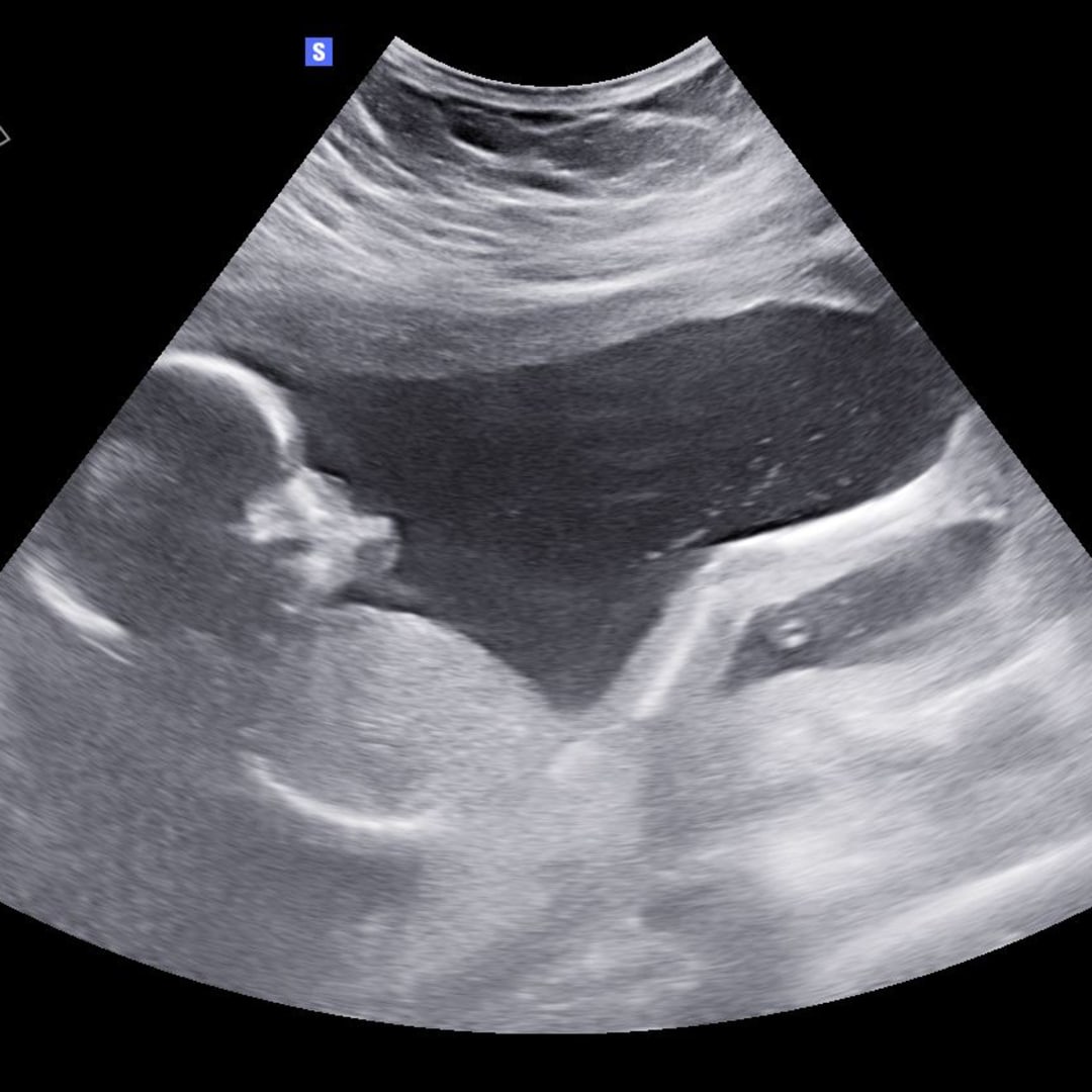 Photo shared by Graci for their Babylist baby registry.
