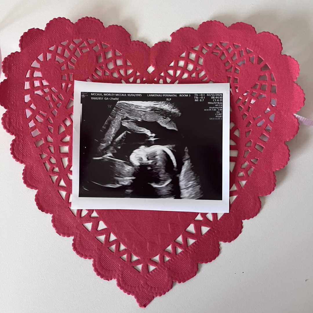Photo shared by Morley for their Babylist baby registry.