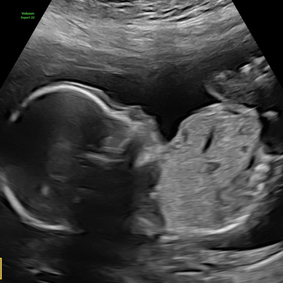 Photo shared by Arlene for their Babylist baby registry.