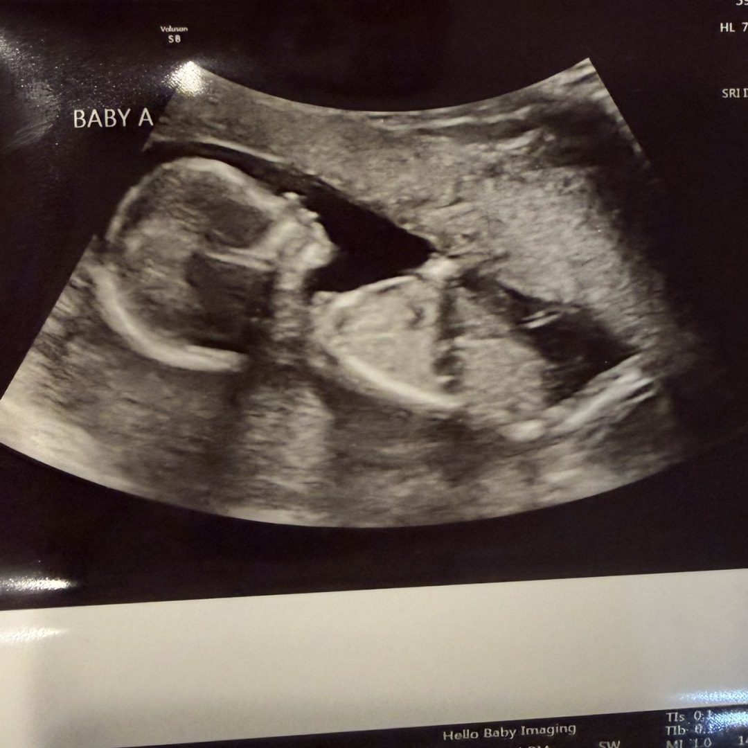 Photo shared by Emily for their Babylist baby registry.