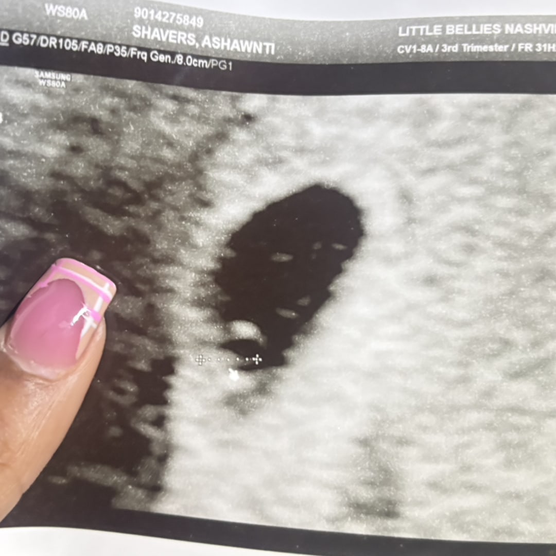 Photo shared by Ashawnti for their Babylist baby registry.