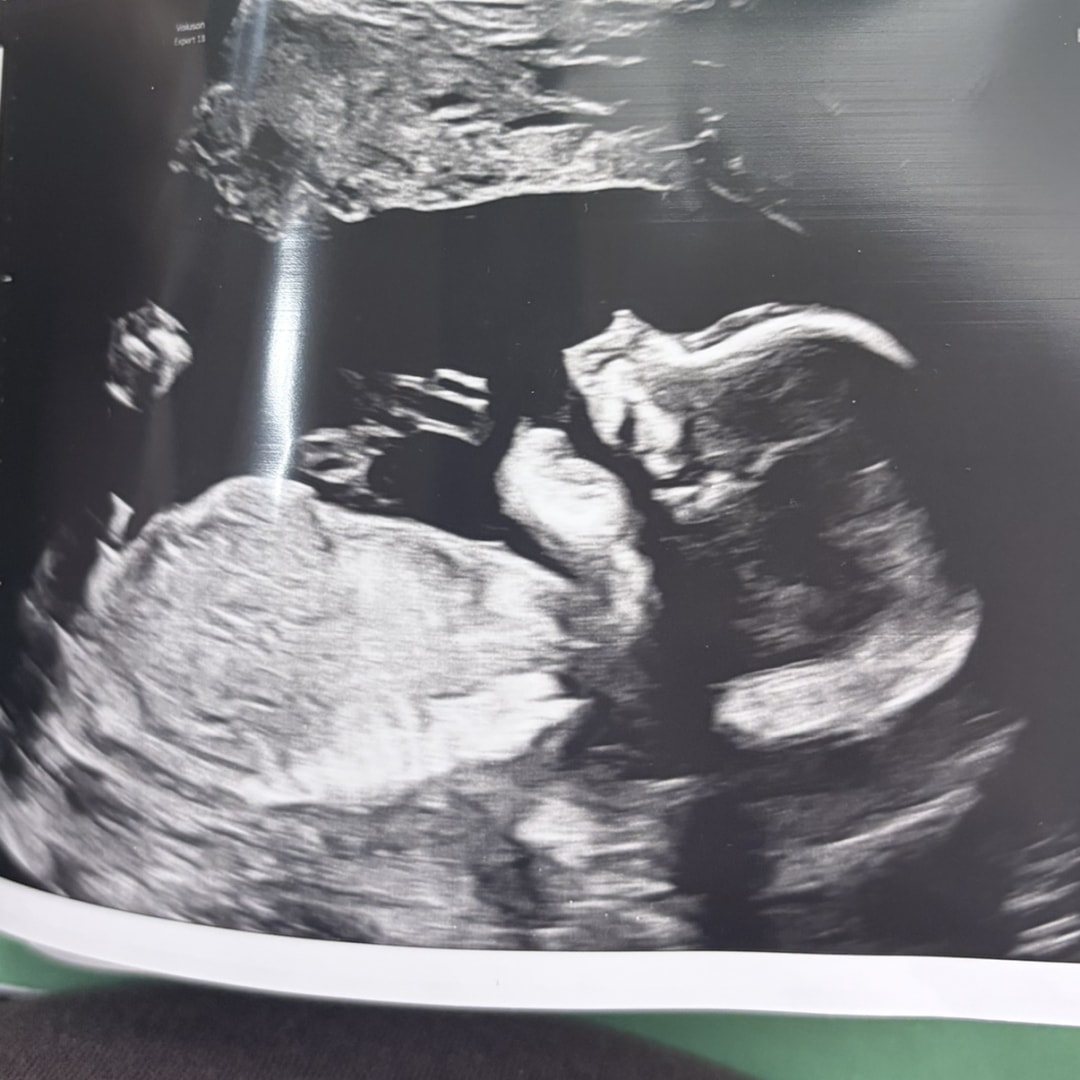 Photo shared by Morgan for their Babylist baby registry.