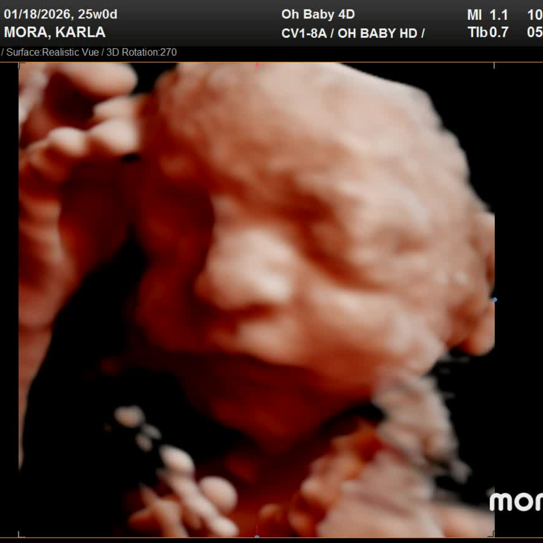 Photo shared by Karla for their Babylist baby registry.