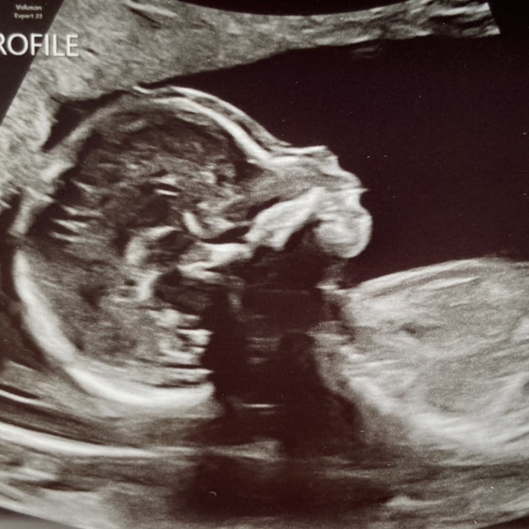 Photo shared by Maureen for their Babylist baby registry.