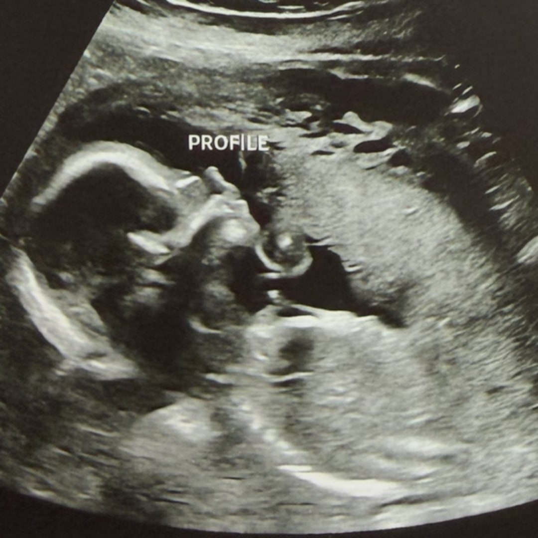 Photo shared by Kaleigh for their Babylist baby registry.