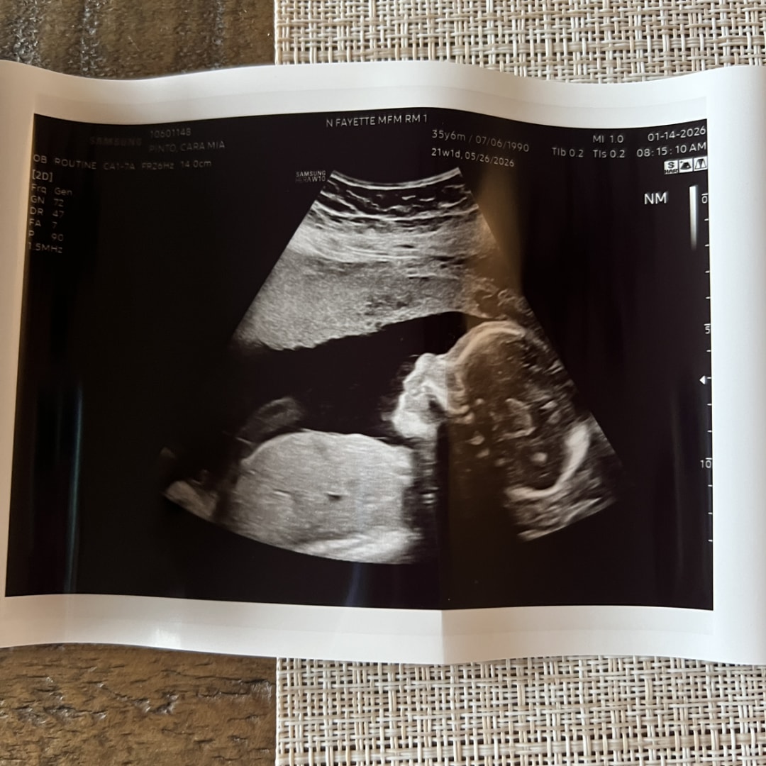 Photo shared by Cara for their Babylist baby registry.