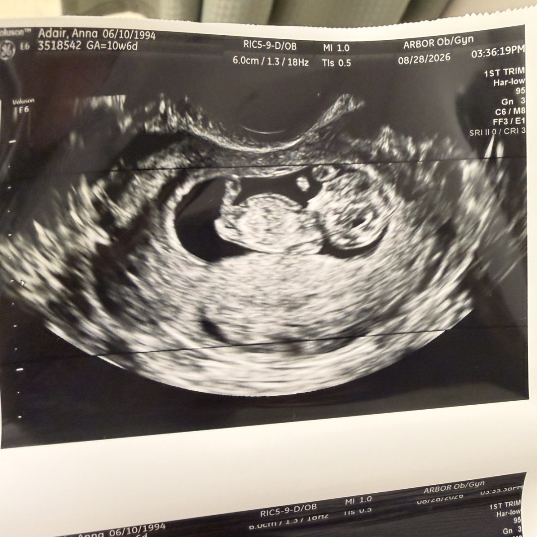 Photo shared by Anna for their Babylist baby registry.