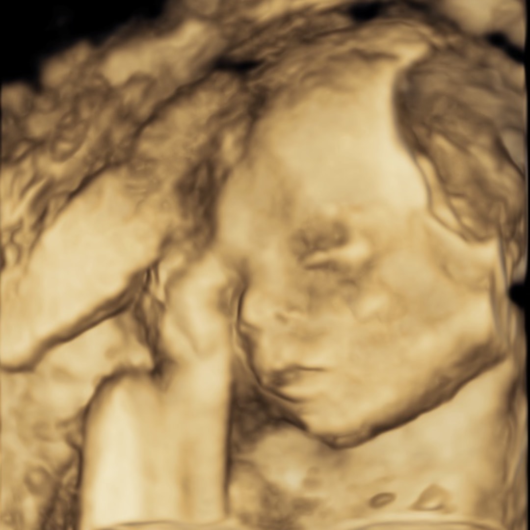 Photo shared by Sammi for their Babylist baby registry.