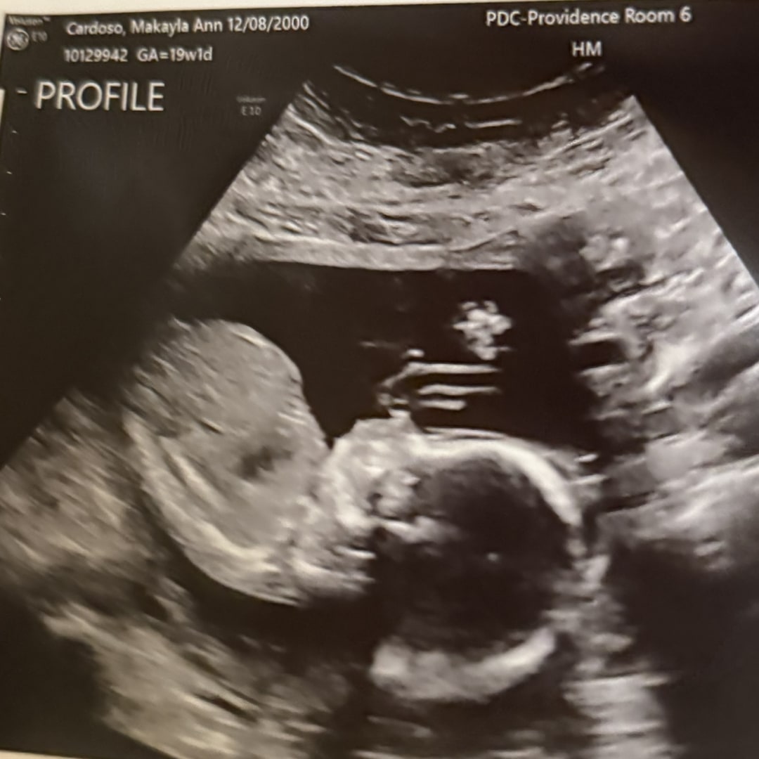 Photo shared by Makayla for their Babylist baby registry.