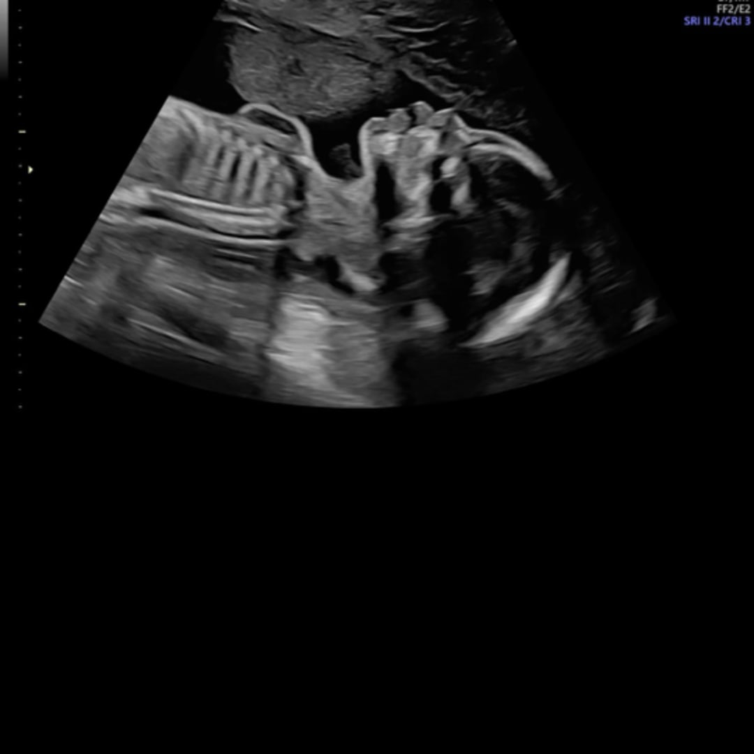 Photo shared by Faith for their Babylist baby registry.
