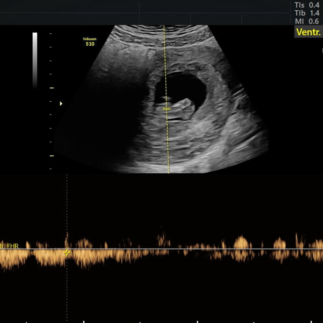 Photo shared by Kialyee for their Babylist baby registry.