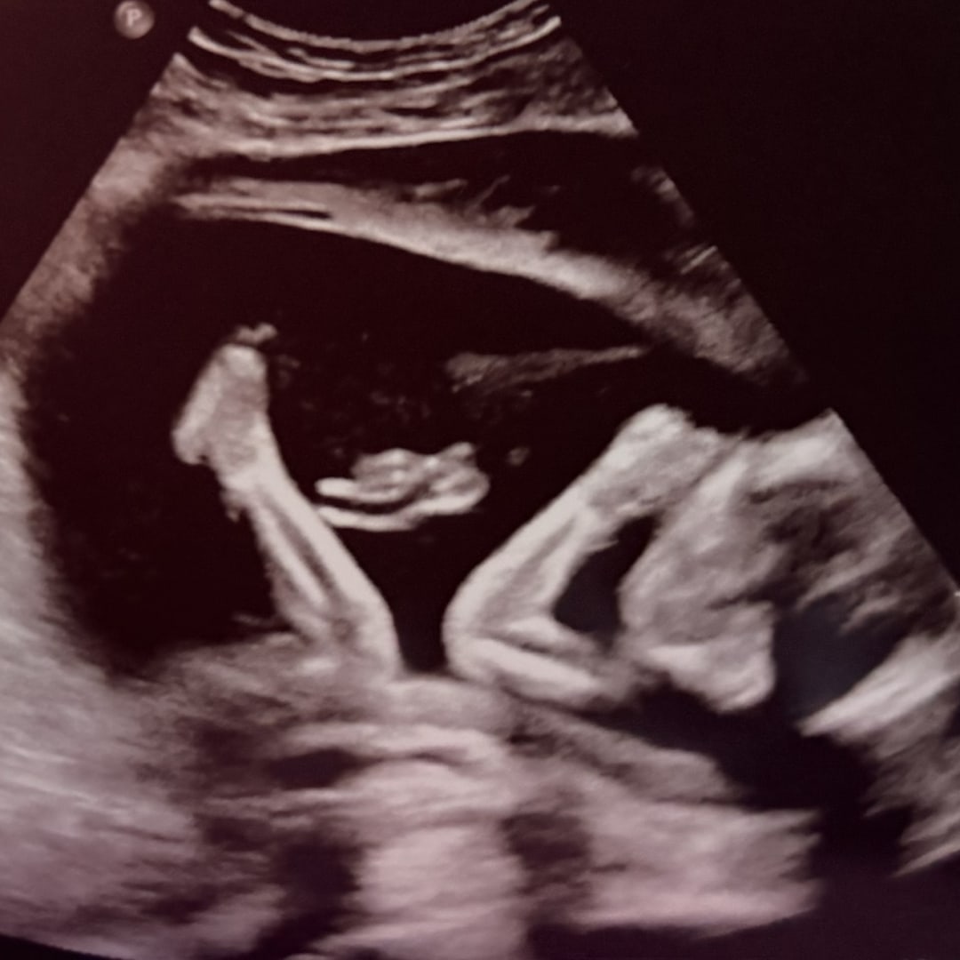 Photo shared by Ana for their Babylist baby registry.