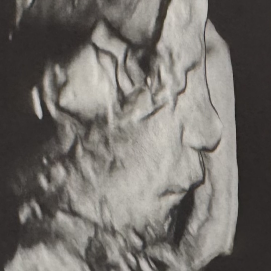 Photo shared by Emily for their Babylist baby registry.