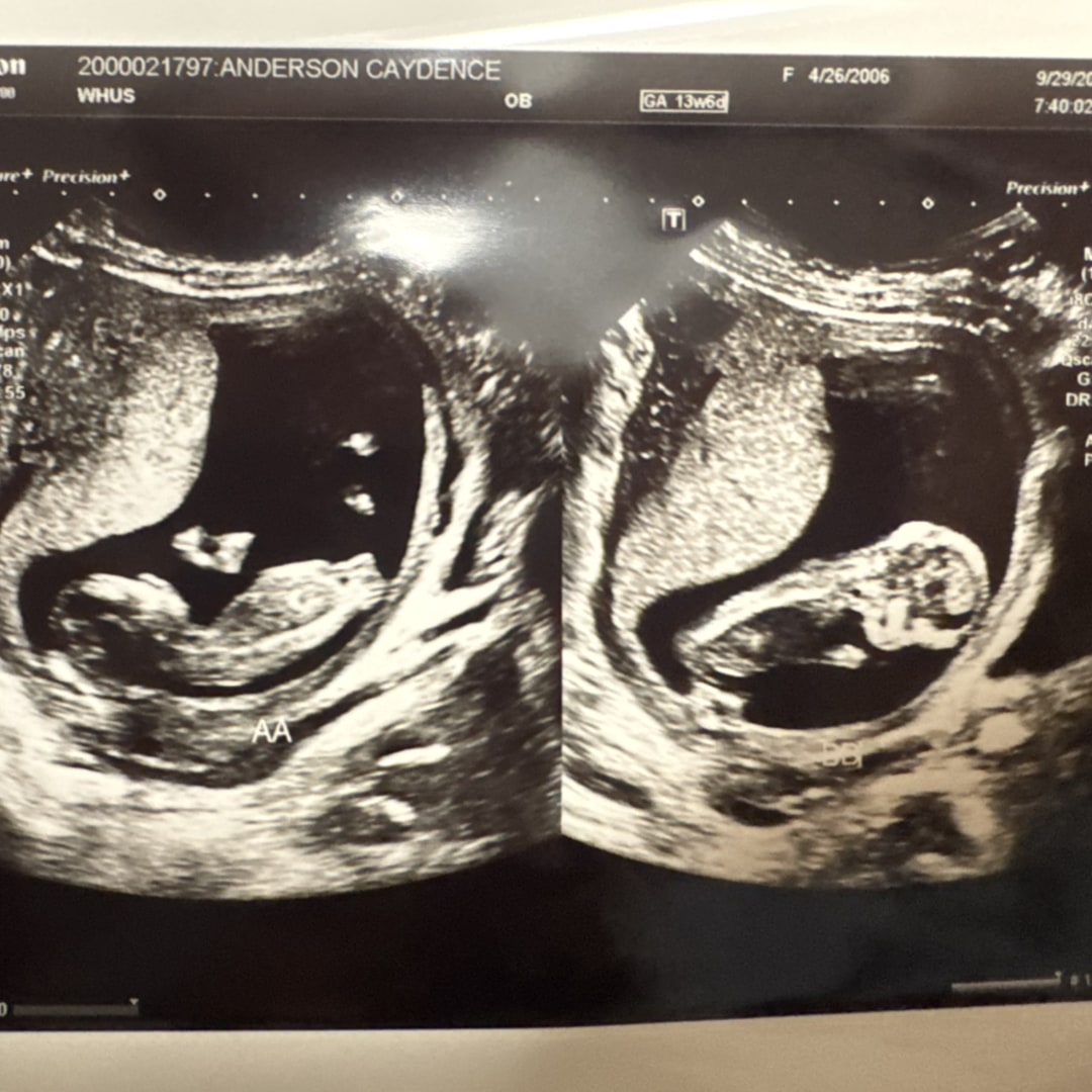 Photo shared by Cadyence for their Babylist baby registry.