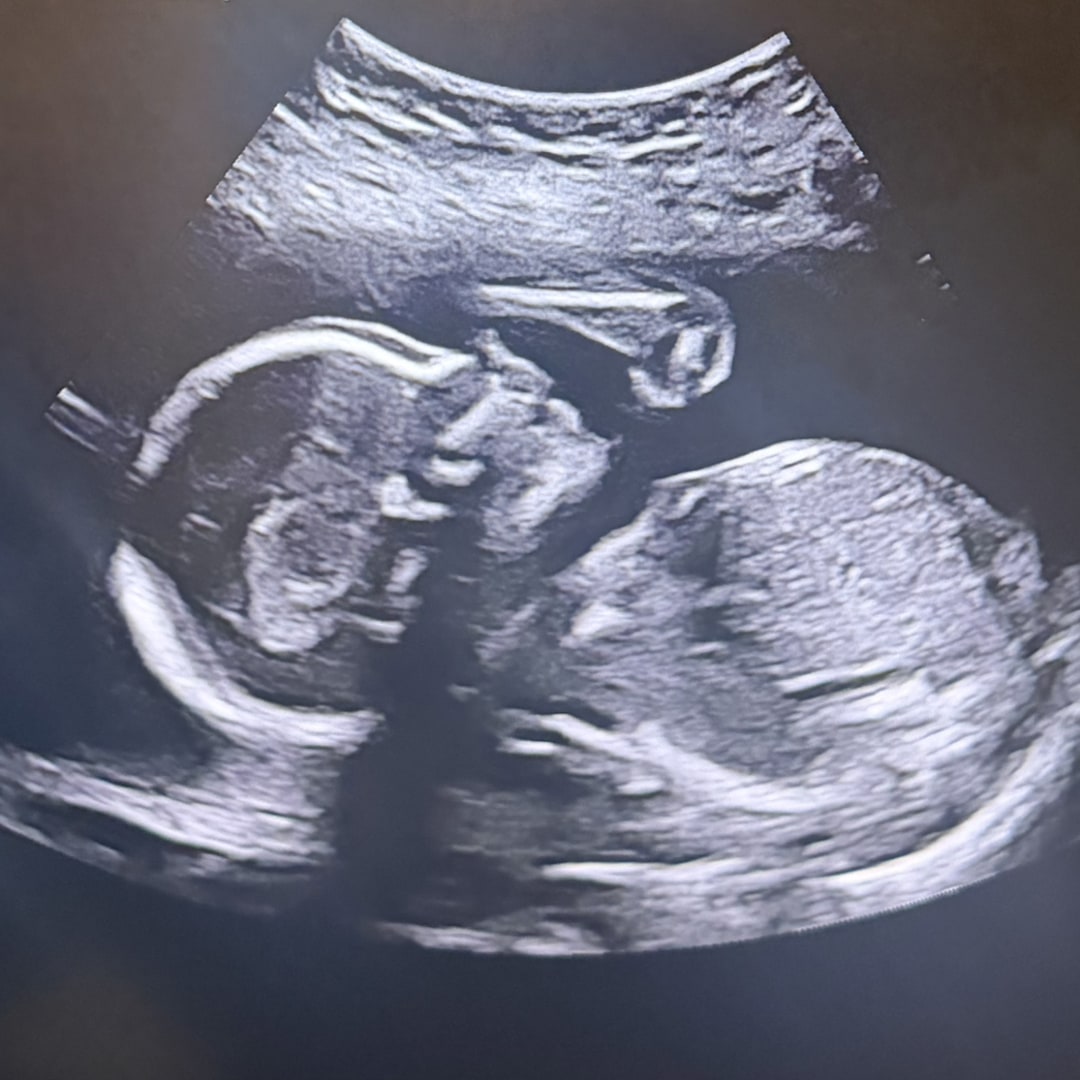 Photo shared by Bethany for their Babylist baby registry.