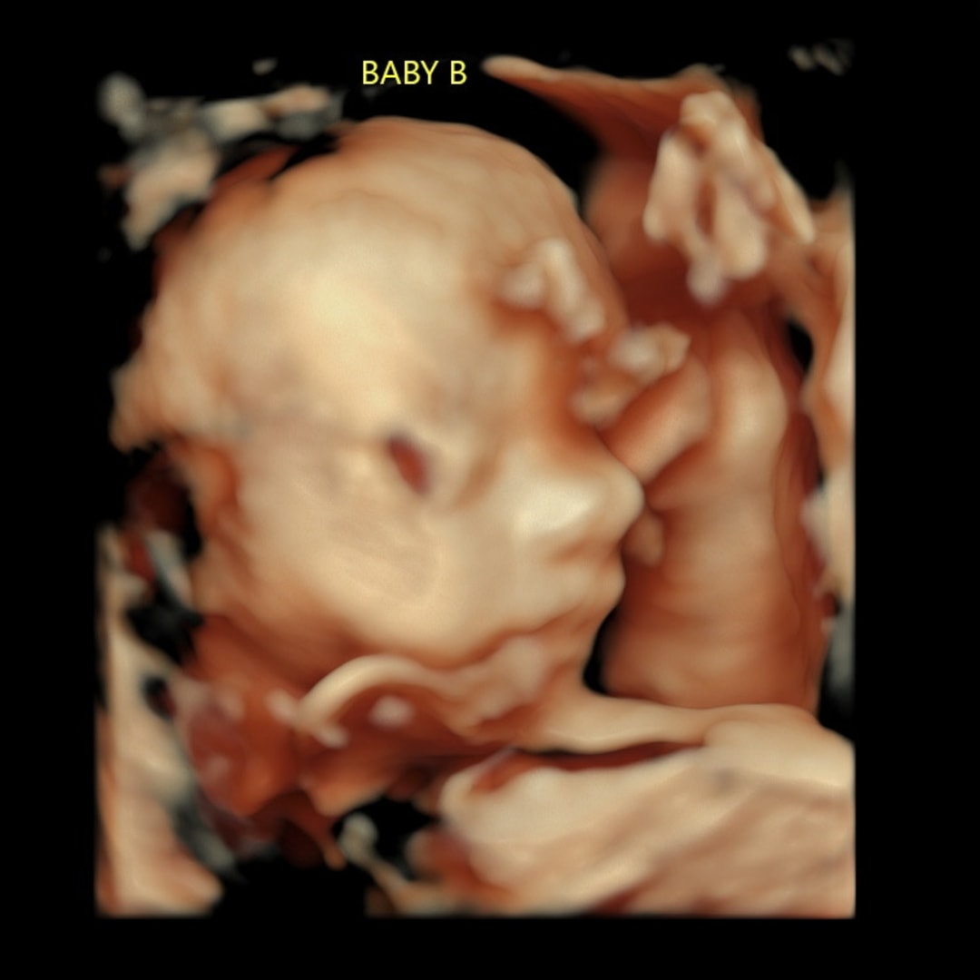Photo shared by Kylee for their Babylist baby registry.