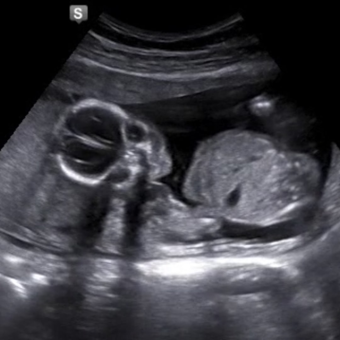 Photo shared by Amanda for their Babylist baby registry.