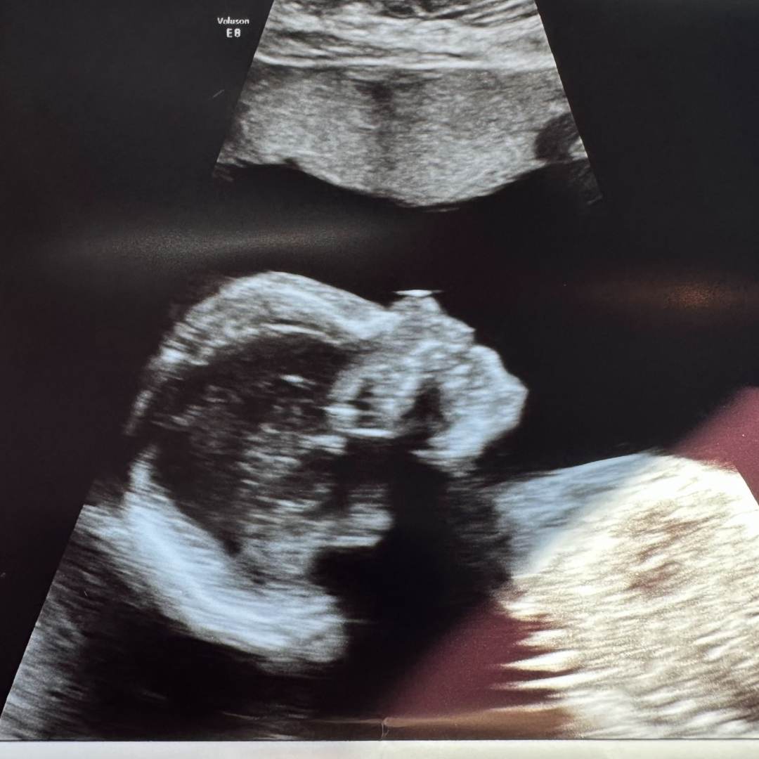 Photo shared by Bridget for their Babylist baby registry.