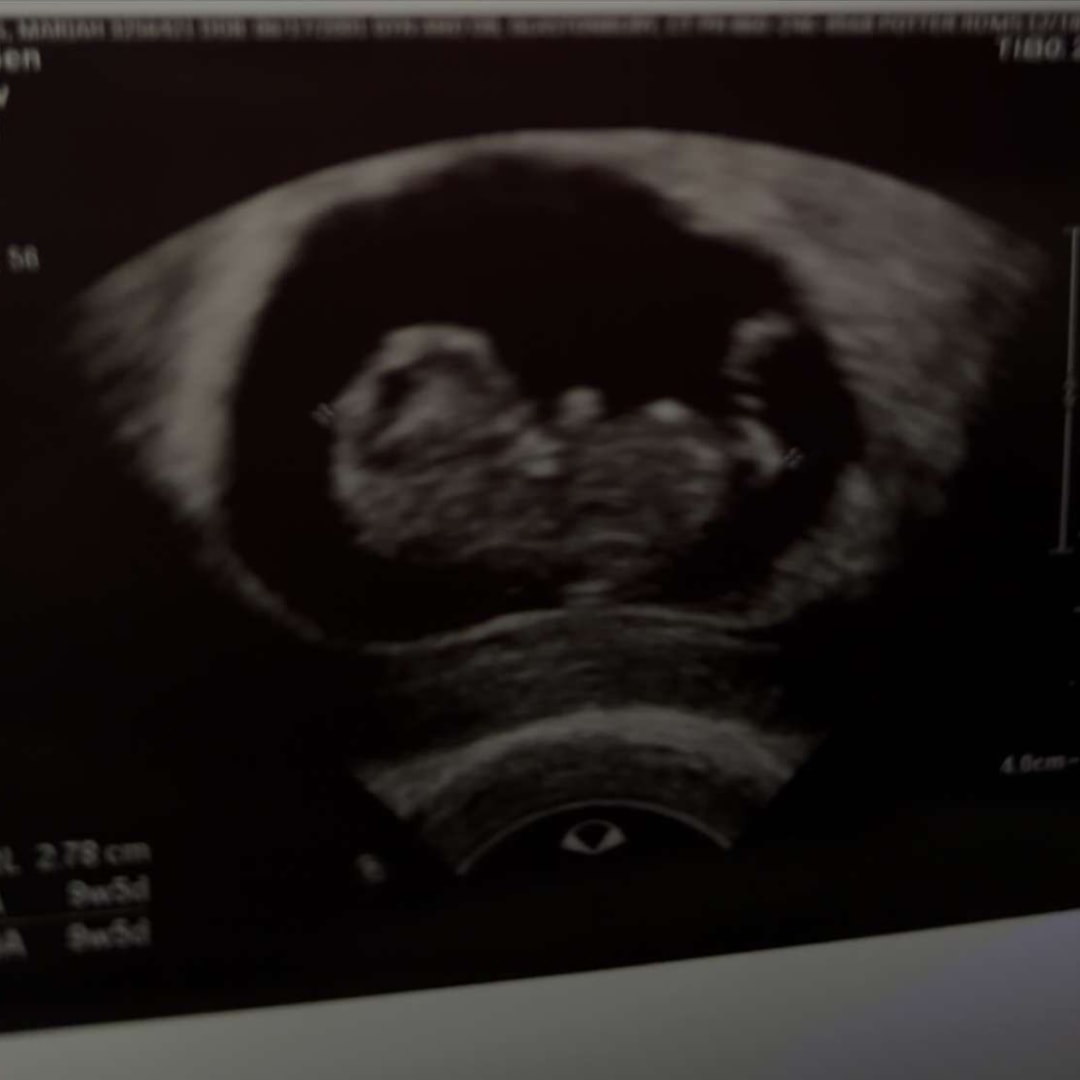Photo shared by Mariah for their Babylist baby registry.