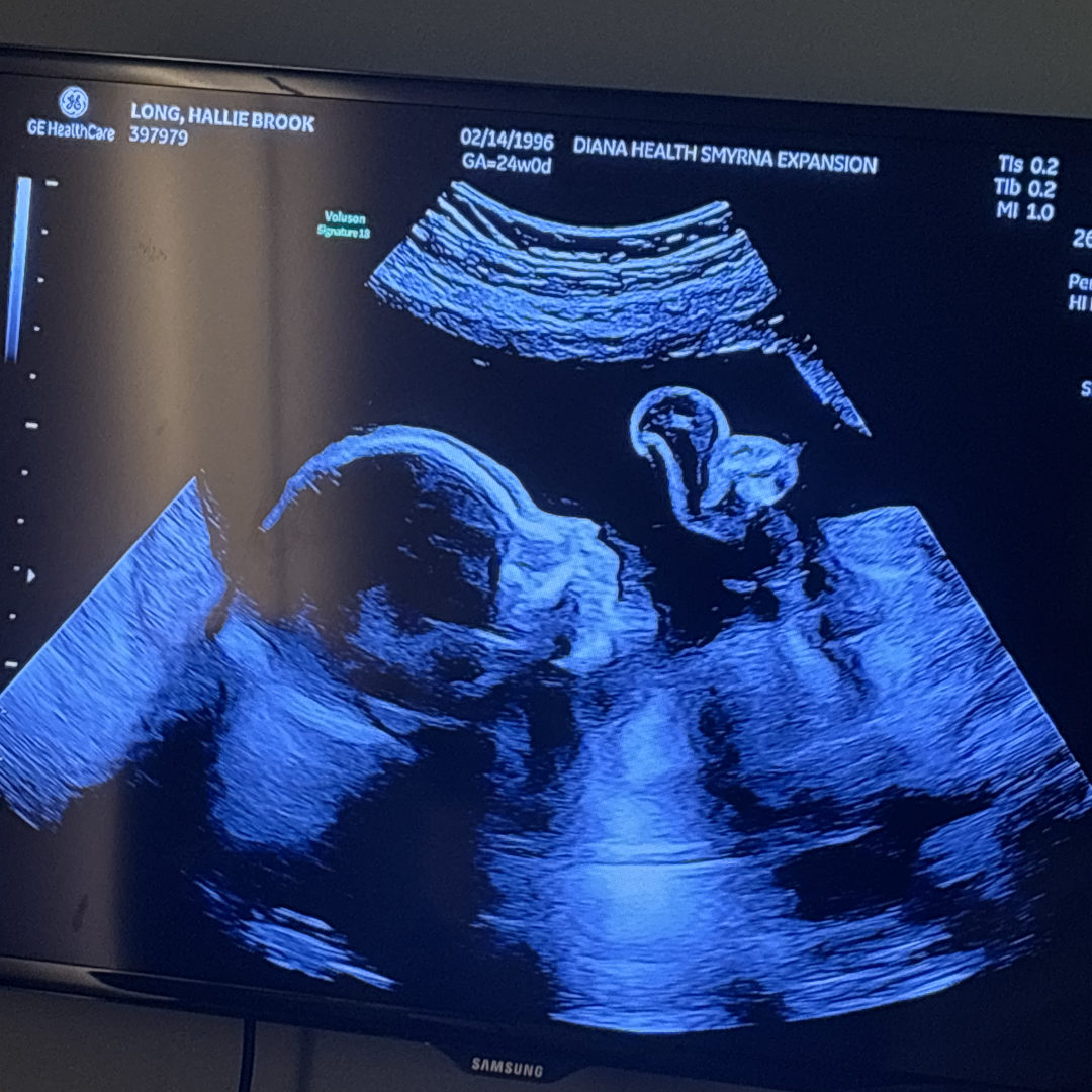 Photo shared by Hallie for their Babylist baby registry.